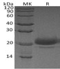 Human WFDC2/HE4 Recombinant Protein (RPES2751)