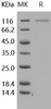 Human CD31/PECAM1 Recombinant Protein (RPES2759)