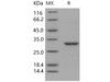 Human 14-3-3 epsilon/YWHAE Recombinant Protein (RPES2765)