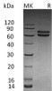 Human JAM-B/CD322 Recombinant Protein (RPES2768)