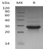 Human WBP1 Recombinant Protein (RPES2789)