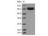 Mouse ART4/CD297 Recombinant Protein (Fc Tag) (RPES2801)
