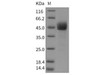 Mouse CD3d/CD3 delta Recombinant Protein (Fc Tag) (RPES2810)