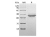 Human Chymotrypsin C Recombinant Protein (RPES2814)