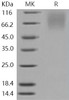 Human LAMP1/CD107a Recombinant Protein (His Tag) (Active) (RPES2839)