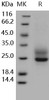 Human Frizzled-5/FZD5 Recombinant Protein (His Tag) (RPES2840)