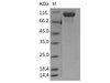 Mouse EGFR Recombinant Protein (His Tag) (Active) (RPES2842)