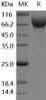 Human VEGFR2/Flk/KDR Recombinant Protein (RPES2862)