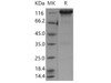 Mouse EGFR Recombinant Protein (Fc Tag) (Active) (RPES2863)
