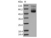 Mouse SerpinA3c Recombinant Protein (His Tag) (RPES2872)