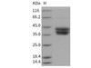 Mouse CD157/BST1 Recombinant Protein (His Tag) (RPES2885)