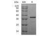 Human SULT1A3 Recombinant Protein (RPES2897)