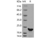 Human N6AMT1/HEMK2 Recombinant Protein (His Tag) (RPES2901)