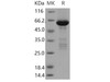 Human TRIB2/TRB2 Recombinant Protein (RPES2907)