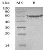 Human KPNA2 Recombinant Protein (RPES2911)