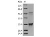 Mouse GLO1/Glyoxalase 1 Recombinant Protein (His Tag) (RPES2914)
