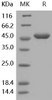 Human G-CSF/CSF3 Recombinant Protein (RPES2924)