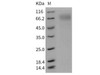 Mouse SR-BI/CD36L1 Recombinant Protein (His Tag) (RPES2926)