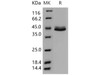Human CD5L Recombinant Protein (His Tag) (RPES2928)