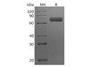 Human EphA7/EHK3 Recombinant Protein (RPES2938)