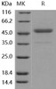 Human CD112/Nectin-2 Recombinant Protein (Active) (RPES2943)
