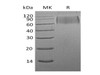 Mouse SIRPA/CD172a Recombinant Protein (RPES2952)