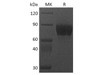 Cynomolgus CSF1R/CD115 Recombinant Protein (RPES2957)