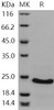Human CSRP1 Recombinant Protein (His Tag) (RPES2960)