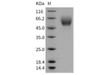 Mouse SerpinA6/CBG Recombinant Protein (His Tag) (RPES2962)