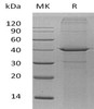 Human Arginase-2/ARG2 Recombinant Protein (RPES2967)