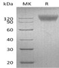 Mouse SIRPA/CD172a Recombinant Protein (RPES2971)