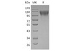 Human ECE1 Recombinant Protein (RPES2975)