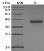 Human Ephrin-A3/EFNA3 Recombinant Protein (RPES3003)