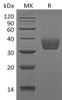 Mouse SLAMF8 Recombinant Protein (RPES3008)