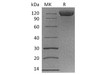Cynomolgus B7-H3/CD276 Recombinant Protein (RPES3013)