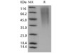 Human CD164/Endolyn Recombinant Protein (His Tag) (RPES3015)