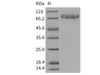 Mouse CLEC14A/EGFR-5 Recombinant Protein (His Tag) (RPES3019)