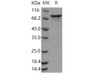 Human CHK1/CHEK1 Recombinant Protein (GST Tag) (Active) (RPES3020)