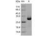 Human AKT3 Recombinant Protein (RPES3021)