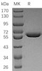 Human Arylsulfatase A/ARSA Recombinant Protein (RPES3022)