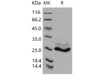 Human K-Ras/K-Ras Recombinant Protein (His Tag) (RPES3035)