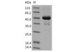 Mouse ALK-2/ACVR1 Recombinant Protein (RPES3040)