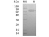 Human RSPO3 Recombinant Protein (RPES3051)