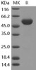 Human Frizzled-4/FZD4 Recombinant Protein (RPES3054)