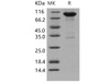 Human EphB2 Recombinant Protein (His & Fc Tag) (Active) (RPES3062)