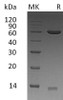 Human ERP57/PDIA3 Recombinant Protein (RPES3066)
