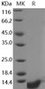 Human COL6A3/Collagen-VI Recombinant Protein (RPES3076)