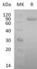 Human Lactotransferrin/LTF Recombinant Protein (RPES3085)