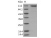 Mouse SR-BI/CD36L1 Recombinant Protein (His & Fc Tag) (RPES3088)