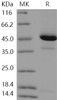 Human REG4/RELP Recombinant Protein (Fc Tag) (RPES3117)